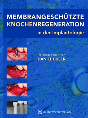 Membrangeschuetzte Knochenregeneration