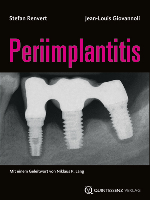 Periimplantitis